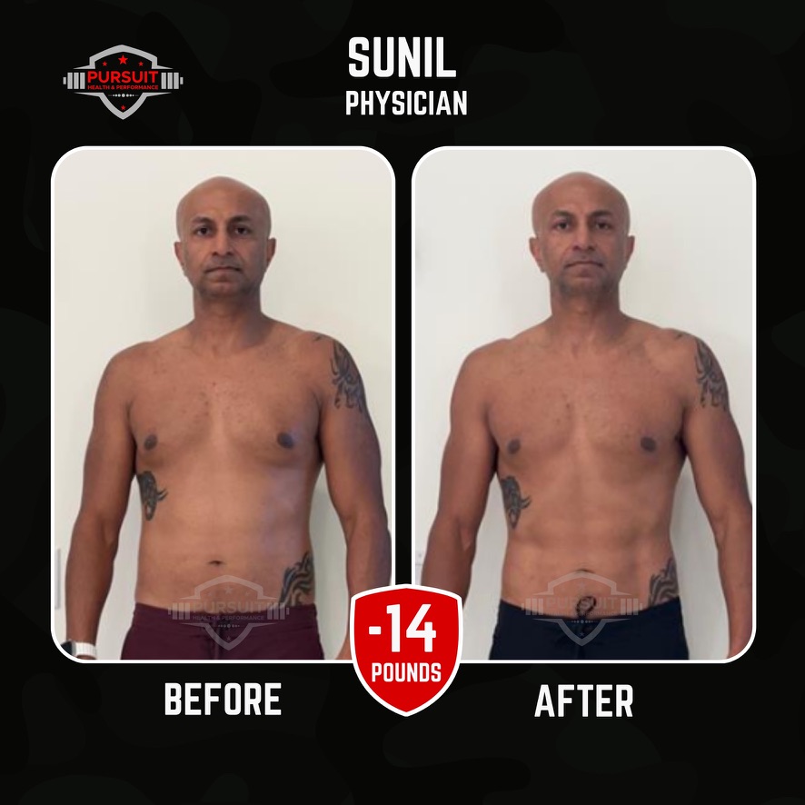 Sunil transformation